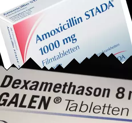 Amoxicillin vs Dexamethason