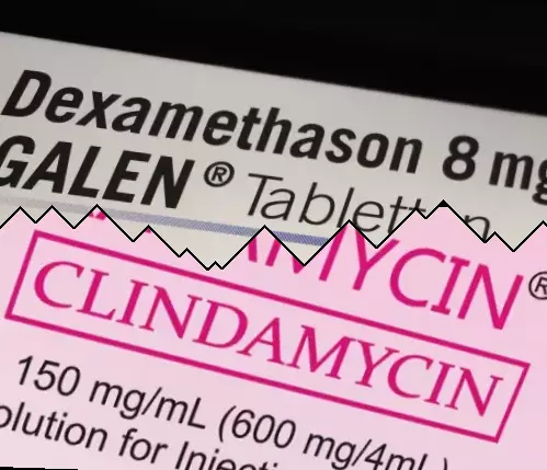 Dexamethason vs Clindamycin